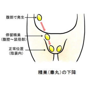 「子供の精巣が降りていない」といわれた