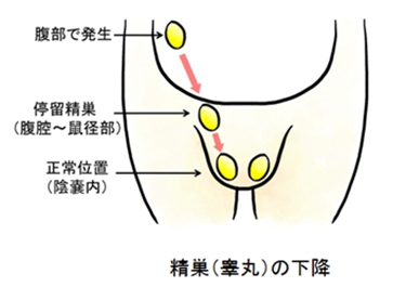 停留精巣