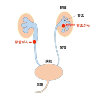 サンプル